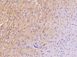 BVES Antibody, Novus Biologicals 100 &mu;g; Unconjugated:Antibodies