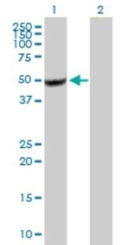 BZW2 Antibody, Novus Biologicals 0.05 mg | Buy Online | Novus Biologicals | Fisher Scientific