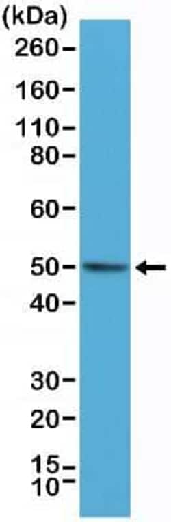 Bag-1 Antibody (RM310), Novus Biologicals 100 &mu;g, Unconjugated:Antibodies,