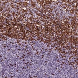 Band 3 Antibody, Novus Biologicals 25 &mu;L | Buy Online | Novus Biologicals | Fisher Scientific