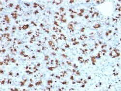 BarX1 Mouse anti-Human, Clone: BARX1/2760, Novus Biologicals 20 &mu;g | Buy Online | Novus Biologicals | Fisher Scientific