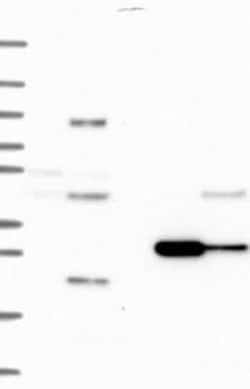 BarX2 Rabbit anti-Human, Polyclonal, Novus Biologicals 25 &mu;g; Unconjugated:Antibodies,