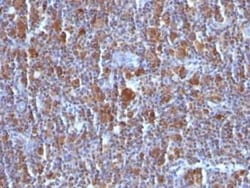 Bax Antibody (BAX/962), Novus Biologicals:Antibodies:Primary Antibodies