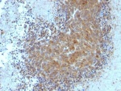 Bax Antibody (BAX/962), Novus Biologicals:Antibodies:Primary Antibodies