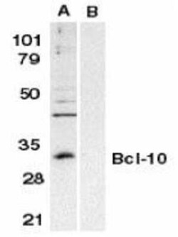 Bcl-10 Antibody - BSA Free, Novus Biologicals 0.1 mg; Unconjugated:Antikörper