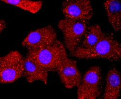 Bcl-2 Antibody (JF104-8), Novus Biologicals 100 &mu;L | Buy Online | Novus Biologicals | Fisher Scientific