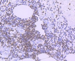 Bcl-2 Antibody (JF104-8), Novus Biologicals 100 &mu;L | Buy Online | Novus Biologicals | Fisher Scientific