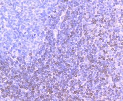 Bcl-2 Antibody (JF104-8), Novus Biologicals 100 &mu;L | Buy Online | Novus Biologicals | Fisher Scientific