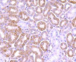 Bcl-2 Antibody (JF104-8), Novus Biologicals 100 &mu;L | Buy Online | Novus Biologicals | Fisher Scientific