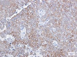 Bcl-2 Rabbit anti-Human, Mouse, Clone: S07-2A1, Novus Biologicals 100 &mu;g | Buy Online | Novus Biologicals | Fisher Scientific