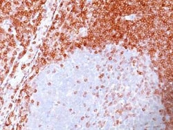 Bcl-2 Antibody (100/D5), Novus Biologicals:Antibodies:Primary Antibodies