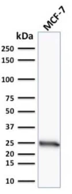 Bcl-2 Antibody (100/D5), Novus Biologicals:Antibodies:Primary Antibodies