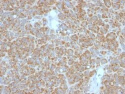 Bcl-2 Antibody (BCL2/782 + BCL2/796), Novus Biologicals 0.1mg; Unlabeled:Antibodies,