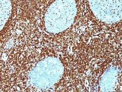Bcl-2 Antibody (BCL2/782 + BCL2/796), Novus Biologicals 0.1mg; Unlabeled:Antibodies,