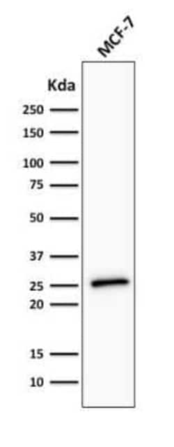 Bcl-2 Antibody (BCL2/782 + BCL2/796), Novus Biologicals 0.1mg; Unlabeled:Antibodies,