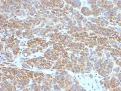 Bcl-2 Antibody (BCL2/782), Novus Biologicals:Antibodies:Primary Antibodies