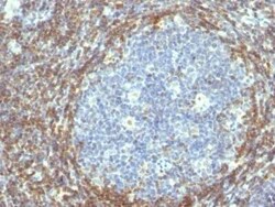 Bcl-2 Antibody (BCL2/782), Novus Biologicals:Antibodies:Primary Antibodies