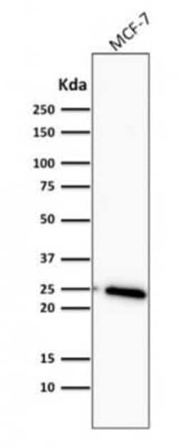 Bcl-2 Antibody (BCL2/782), Novus Biologicals:Antibodies:Primary Antibodies