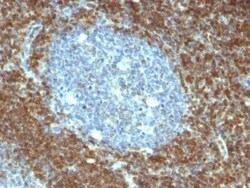 Bcl-2 Antibody (BCL2/796), Novus Biologicals 0.1mg; Unlabeled:Antibodies,