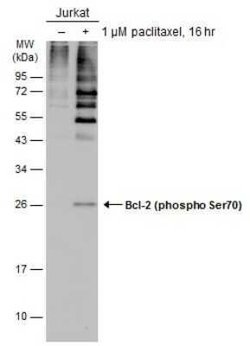 Bcl-2, p Ser70 Antibody, Novus Biologicals 100 &mu;g; Unconjugated:Antibodies,