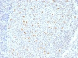 Bcl-6 Antibody (BCL6/1526) - Azide and BSA Free, Novus Biologicals 100 &mu;g | Buy Online | Novus Biologicals | Fisher Scientific