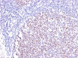 Bcl-6 Rabbit anti-Human, Clone: BCL6/2497R, Novus Biologicals 20 &mu;g;