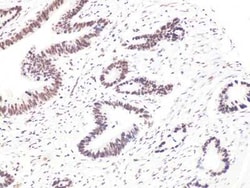 Bcl-9 Antibody - BSA Free, Novus Biologicals:Antibodies:Primary Antibodies