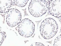 Bcl-9 Antibody - BSA Free, Novus Biologicals:Antibodies:Primary Antibodies