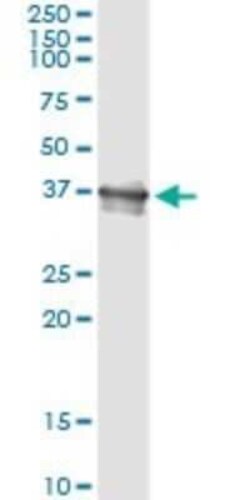 Bcl G Antibody (1D11), Novus Biologicals 0.1 mg | Buy Online | Novus Biologicals | Fisher Scientific