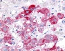 Beclin 1 Antibody Pack, Novus Biologicals 4 Vials; Unconjugated:Antibodies