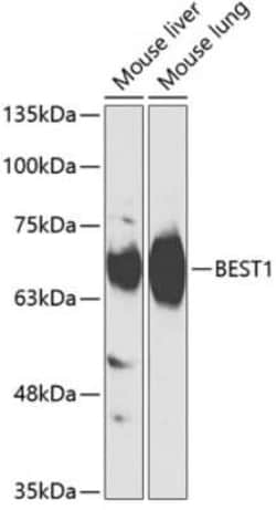 Bestrophin 1 Antibody - BSA Free, Novus Biologicals:Anticorps:Anticorps