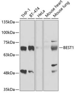Bestrophin 1 Antibody - BSA Free, Novus Biologicals 0.1 mL, Unconjugated:Antibodies,