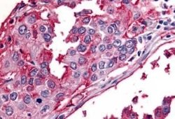 Bestrophin 2 Antibody, Novus Biologicals 50 &mu;g; Unconjugated:Antibodies,