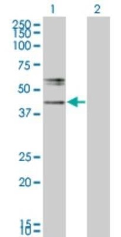 Beta-1,3-N-Acetylglucosaminyltransferase 2/B3GNT2 Antibody (1A8), Novus Biologicals 0.1 mg | Buy Online | Novus Biologicals | Fisher Scientific