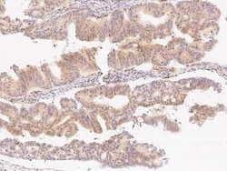 Beta-1,3-N-Acetylglucosaminyltransferase 2/B3GNT2 Antibody, Novus Biologicals