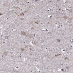 Beta-1,3-N-Acetylglucosaminyltransferase 6/B3GNT6 Antibody, Novus Biologicals:Antibodies:Primary