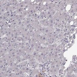 Beta-1,3-N-Acetylglucosaminyltransferase 6/B3GNT6 Antibody, Novus Biologicals:Antibodies:Primary