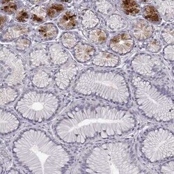 Beta-1,3-N-Acetylglucosaminyltransferase 6/B3GNT6 Antibody, Novus Biologicals:Antibodies:Primary