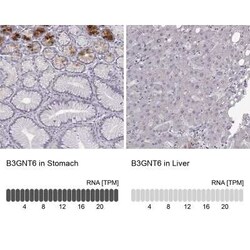 Beta-1,3-N-Acetylglucosaminyltransferase 6/B3GNT6 Antibody, Novus Biologicals:Antibodies:Primary