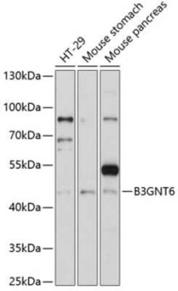 Beta-1,3-N-Acetylglucosaminyltransferase 6/B3GNT6 Antibody - Azide and
