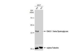Beta Dystroglycan Antibody (GT9112), Novus Biologicals 100 &mu;g; Unconjugated:Antibodies,