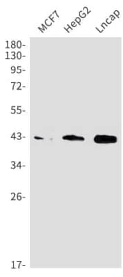 Beta Dystroglycan Antibody (S05-5B5), Novus Biologicals 50 &mu;g; Unconjugated:Antikörper