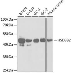 Beta Hydroxysteroid Dehydrogenase Antibody - Azide and BSA Free, Novus