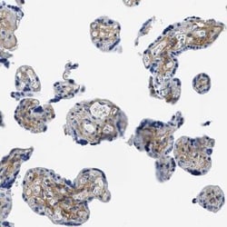 Beta Ig-h3/TGFBI Antibody, Novus Biologicals:Antibodies:Primary Antibodies