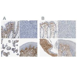 Beta Ig-h3/TGFBI Antibody, Novus Biologicals:Antibodies:Primary Antibodies