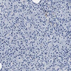 Beta Ig-h3/TGFBI Antibody, Novus Biologicals:Antibodies:Primary Antibodies