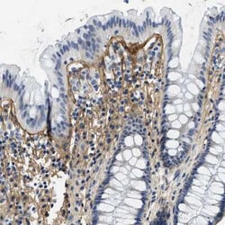 Beta Ig-h3/TGFBI Antibody, Novus Biologicals:Antibodies:Primary Antibodies