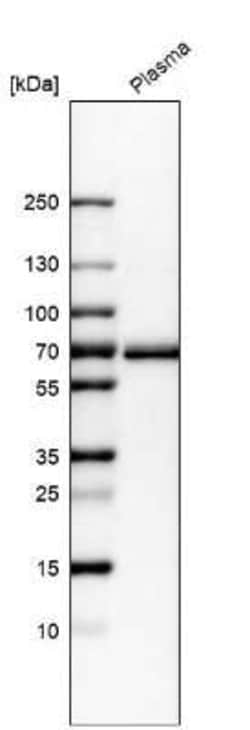Beta Ig-h3/TGFBI Antibody, Novus Biologicals:Antibodies:Primary Antibodies