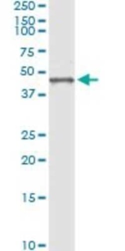 Biglycan Antibody (4E1-1G7), Novus Biologicals 0.1 mg | Buy Online | Novus Biologicals | Fisher Scientific