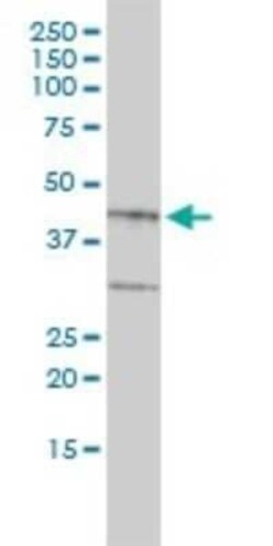 Biglycan Antibody (4E1-1G7), Novus Biologicals 0.1 mg | Buy Online | Novus Biologicals | Fisher Scientific